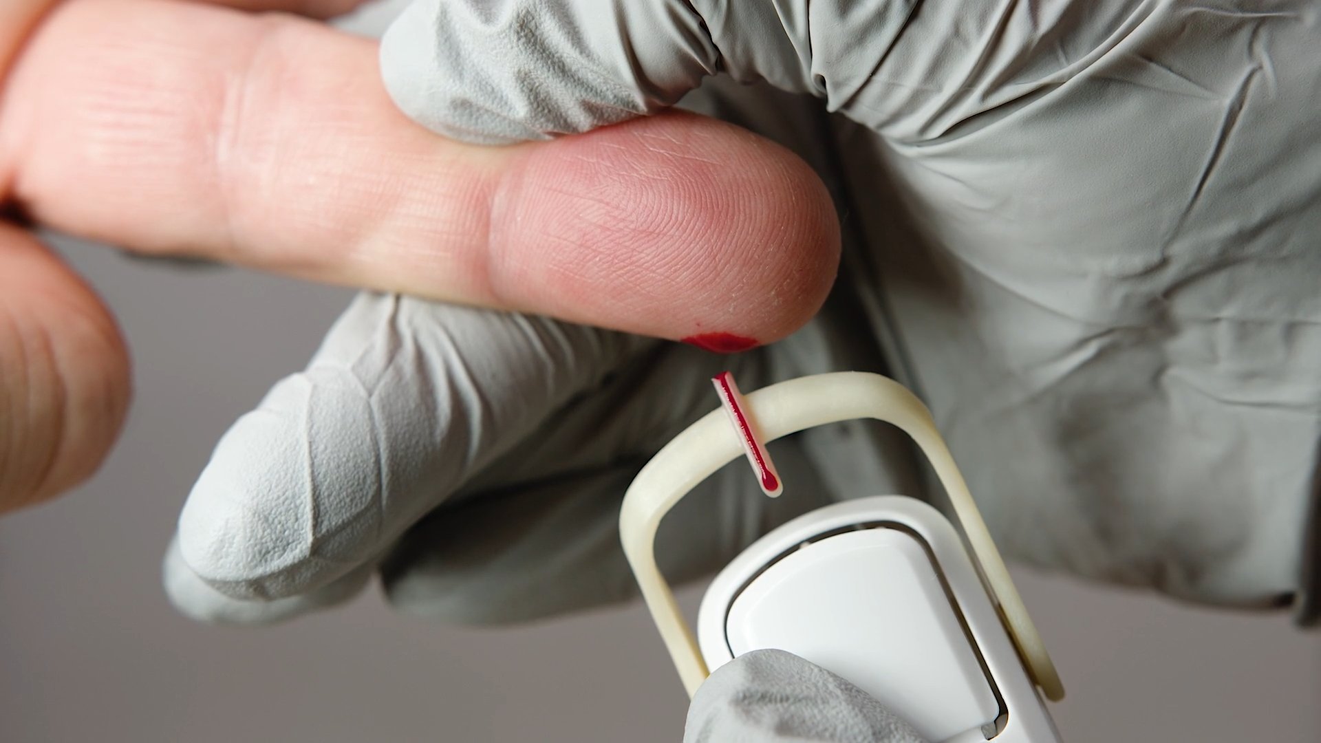 Collect blood sample